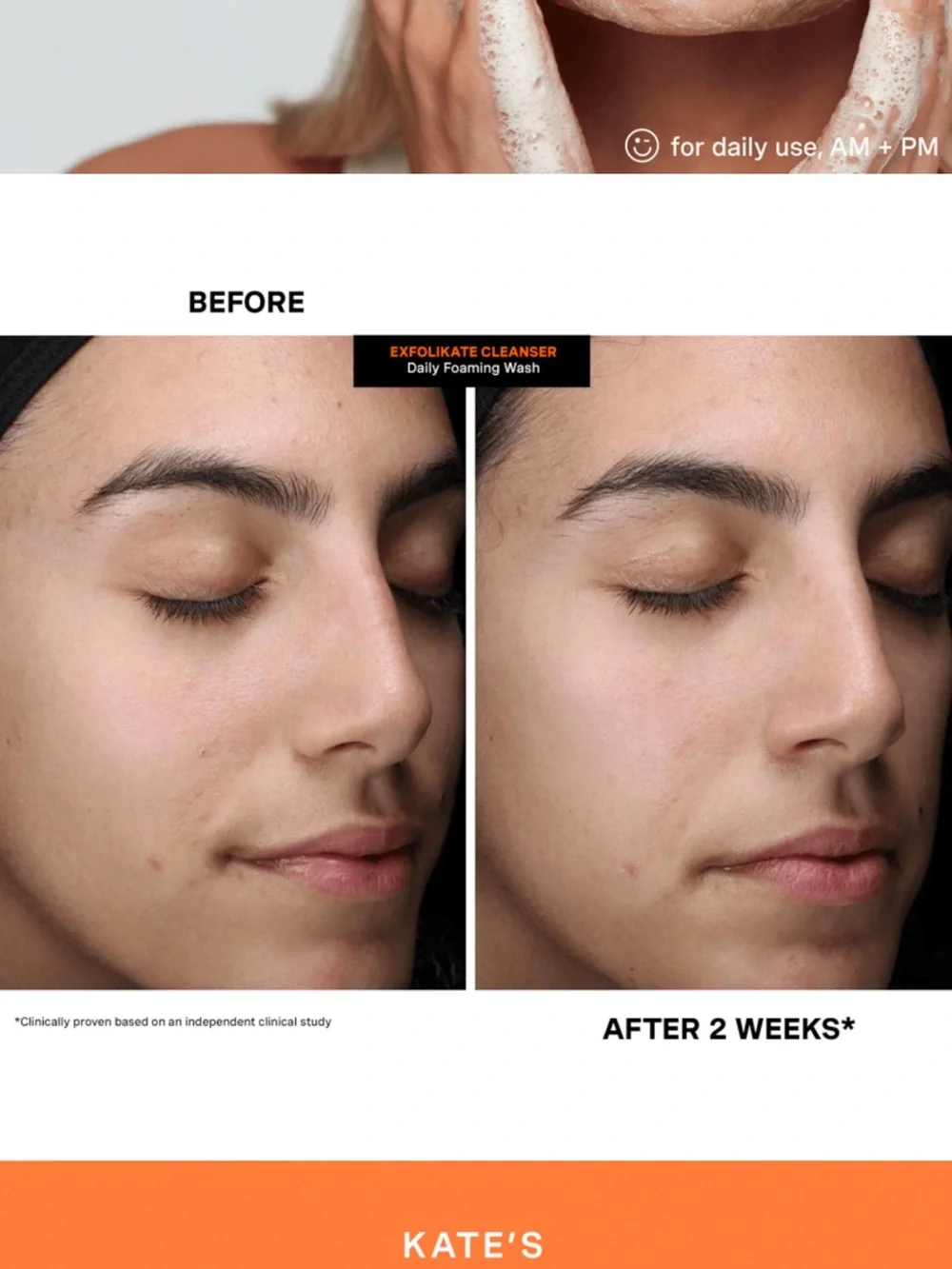 Kate Somerville - ExfoliKate Cleanser Daily Foaming Wash